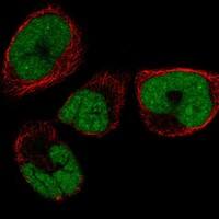 Staining of human cell line RH-30 shows localization to nucleoplasm.