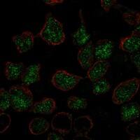 Staining of human cell line REH shows localization to nucleoplasm.