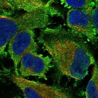 Staining of human cell line HeLa shows localization to plasma membrane.