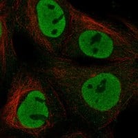 Staining of human cell line SuSa shows localization to nucleoplasm.
