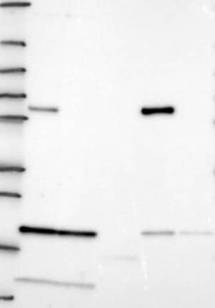 Lane 1: Marker [kDa] 250, 130, 95, 72, 55, 36, 28, 17, 10 | Lane 2: RT4 | Lane 3: U-251 MG | Lane 4: Human Plasma | Lane 5: Liver | Lane 6: Tonsil