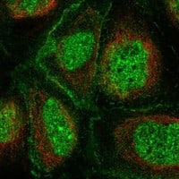 Staining of human cell line A-431 shows localization to nucleoplasm, nucleoli & plasma membrane.