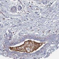 Staining of human breast shows extracellular positivity.