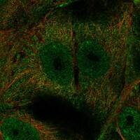 Staining of human cell line EFO-21 shows localization to nucleoplasm, plasma membrane & cytosol.