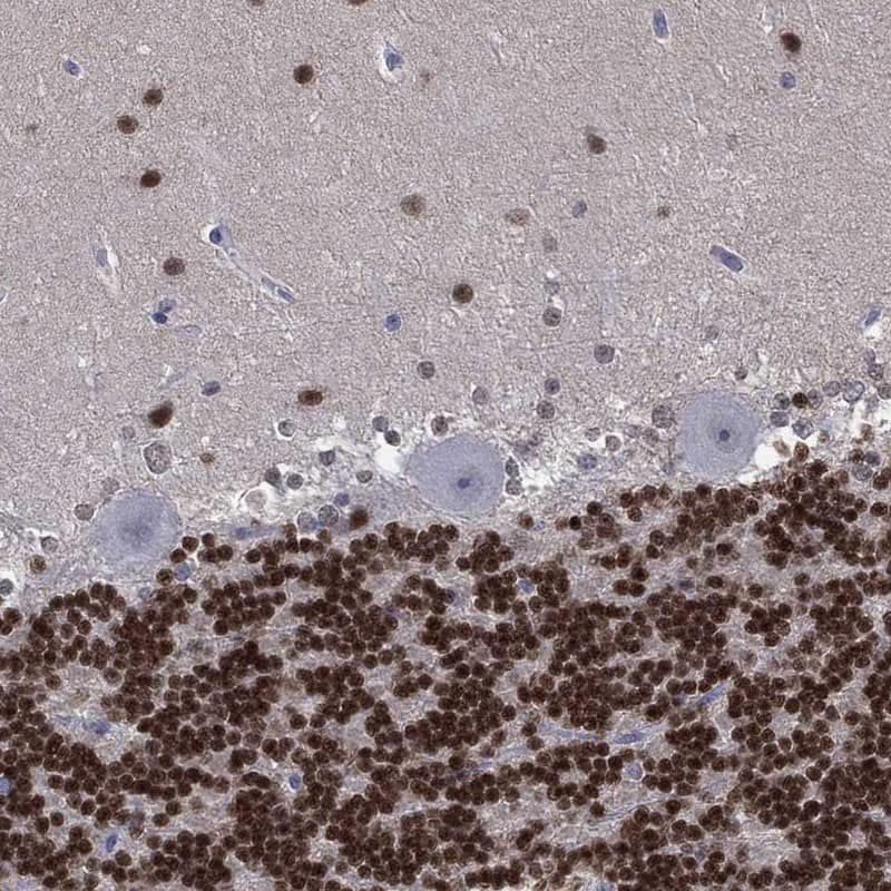Staining of human cerebellum shows low expression as expected.