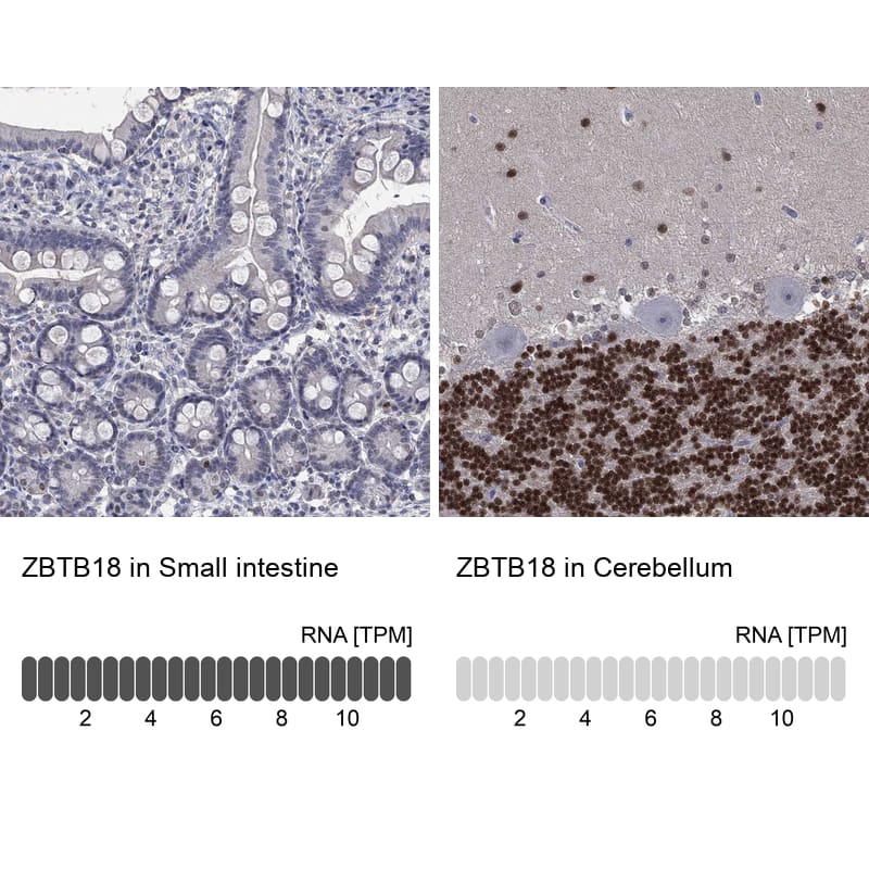 <b>Orthogonal Strategies Validation. </b>Analysis in human small intestine and cerebellum tissues using Anti-ZBTB18 antibody. Corresponding ZBTB18 RNA-seq data are presented for the same tissues.