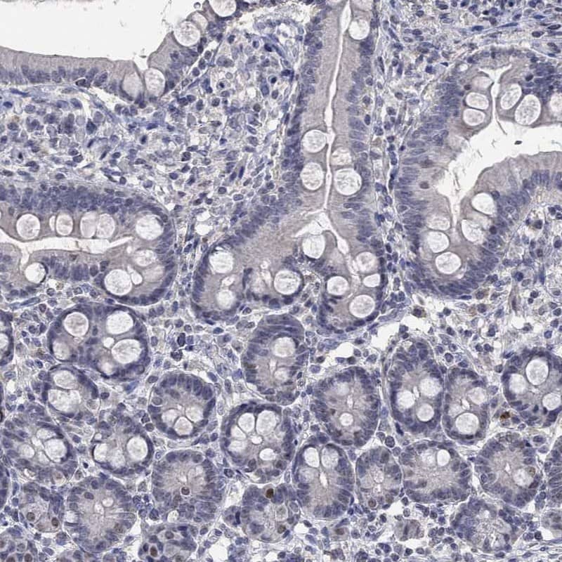 Staining of human small intestine shows high expression.