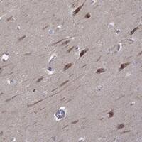 Staining of human hippocampus shows strong cytoplasmic positivity in neuronal cells.