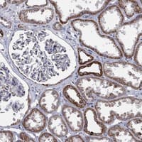 Staining of human kidney shows strong cytoplasmic positivity in cells in tubules.