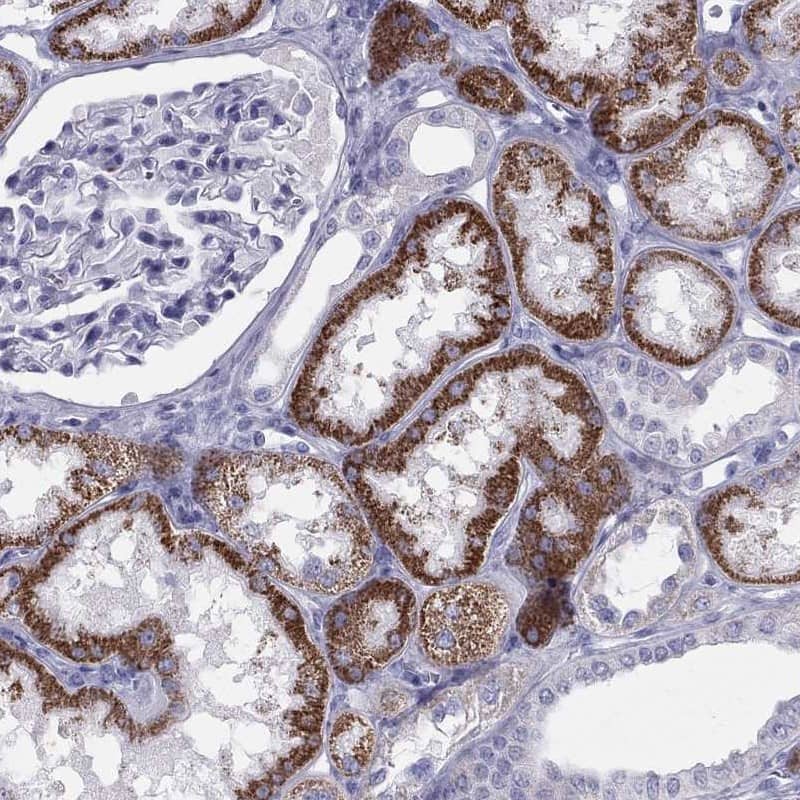 <b>Orthogonal Strategies Validation. </b>Staining of human kidney shows high expression.