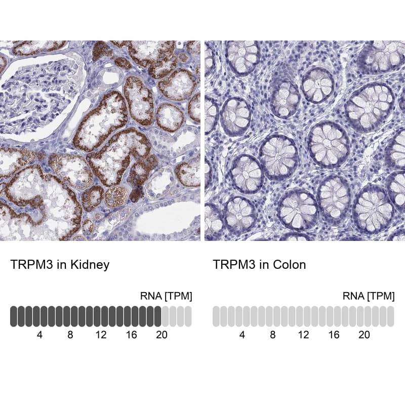 Analysis in human kidney and colon tissues using Anti-TRPM3 antibody. Corresponding TRPM3 RNA-seq data are presented for the same tissues.