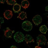 Staining of human cell line K-562 shows localization to nucleoplasm & cytosol.