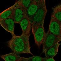 Staining of human cell line SH-SY5Y shows localization to nucleoplasm & plasma membrane.