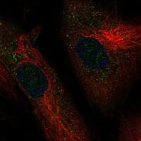 Staining of human cell line ASC TERT1 shows localization to vesicles.