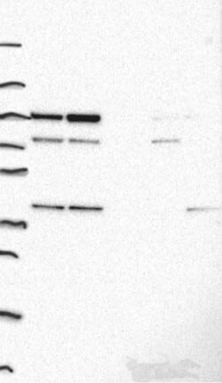 Lane 1: Marker [kDa] 250, 130, 95, 72, 55, 36, 28, 17, 10 | Lane 2: RT4 | Lane 3: U-251 MG | Lane 4: Human Plasma | Lane 5: Liver | Lane 6: Tonsil