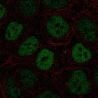 Staining of human cell line RT4 shows localization to nucleoplasm.