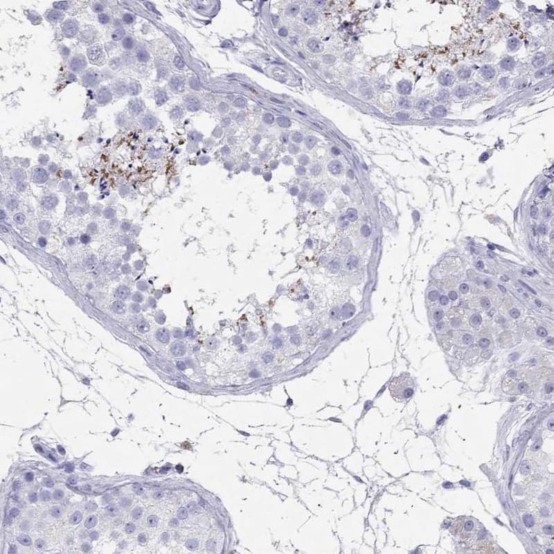 Immunohistochemistry-Paraffin ARMC12 Antibody - BSA Free