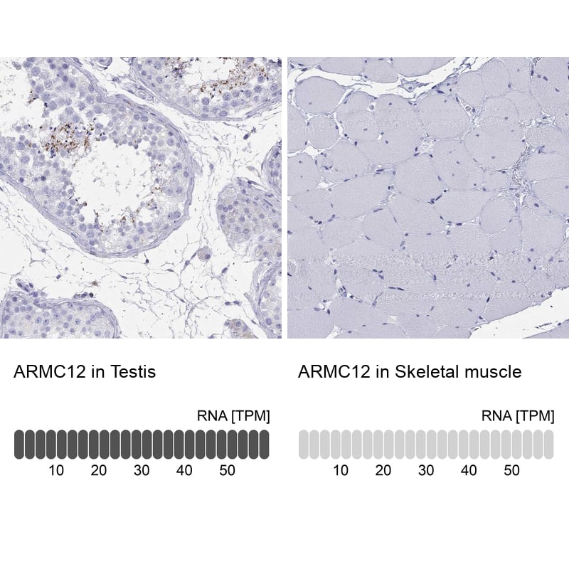 Immunohistochemistry-Paraffin ARMC12 Antibody - BSA Free
