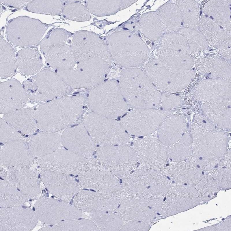 Immunohistochemistry-Paraffin ARMC12 Antibody - BSA Free