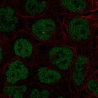 Staining of human cell line RT4 shows localization to nucleoplasm.