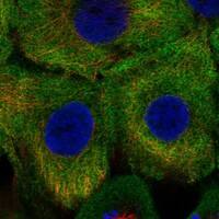 Staining of human cell line HaCaT shows localization to cytosol & endoplasmic reticulum.