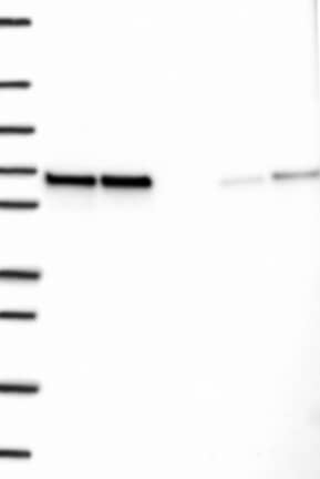 Lane 1: Marker [kDa] 250, 130, 95, 72, 55, 36, 28, 17, 10 | Lane 2: RT4 | Lane 3: U-251 MG | Lane 4: Human Plasma | Lane 5: Liver | Lane 6: Tonsil