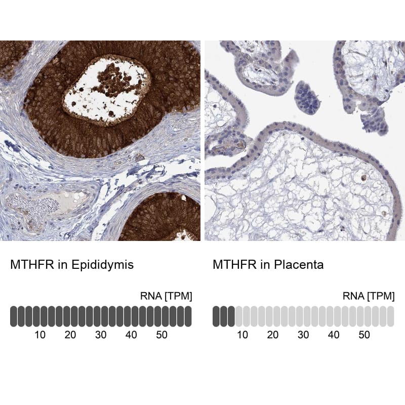 <b>Orthogonal Strategies Validation. </b>Analysis in human epididymis and placenta tissues using Anti-MTHFR antibody. Corresponding MTHFR RNA-seq data are presented for the same tissues.