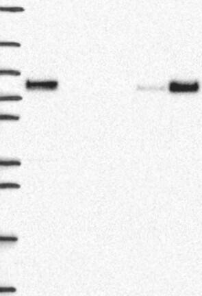 Lane 1: Marker [kDa] 250, 130, 95, 72, 55, 36, 28, 17, 10 | Lane 2: RT4 | Lane 3: U-251 MG | Lane 4: Human Plasma | Lane 5: Liver | Lane 6: Tonsil