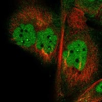 Staining of human cell line EFO-21 shows localization to nucleoplasm, nuclear bodies & cytosol.