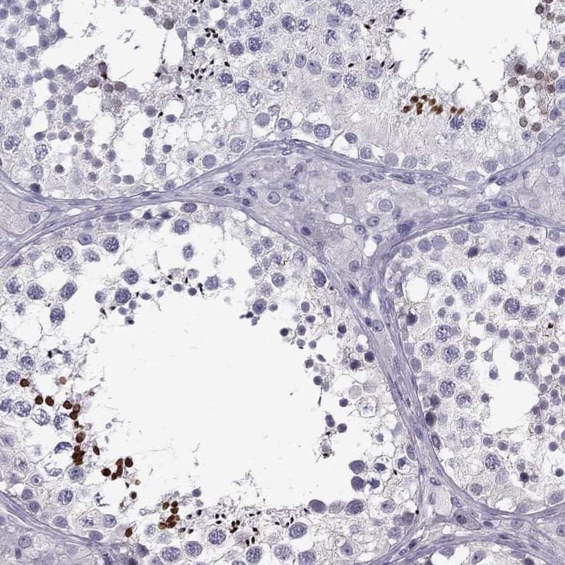 Immunohistochemistry-Paraffin TP53TG5 Antibody - BSA Free