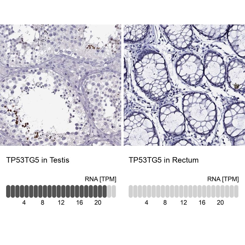 Immunohistochemistry-Paraffin TP53TG5 Antibody - BSA Free