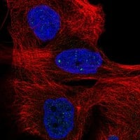 Staining of human cell line EFO-21 shows localization to nuclear bodies.