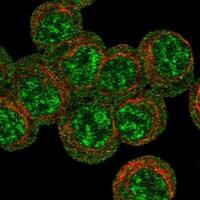 Staining of human cell line HEL shows localization to nuclear speckles & plasma membrane.