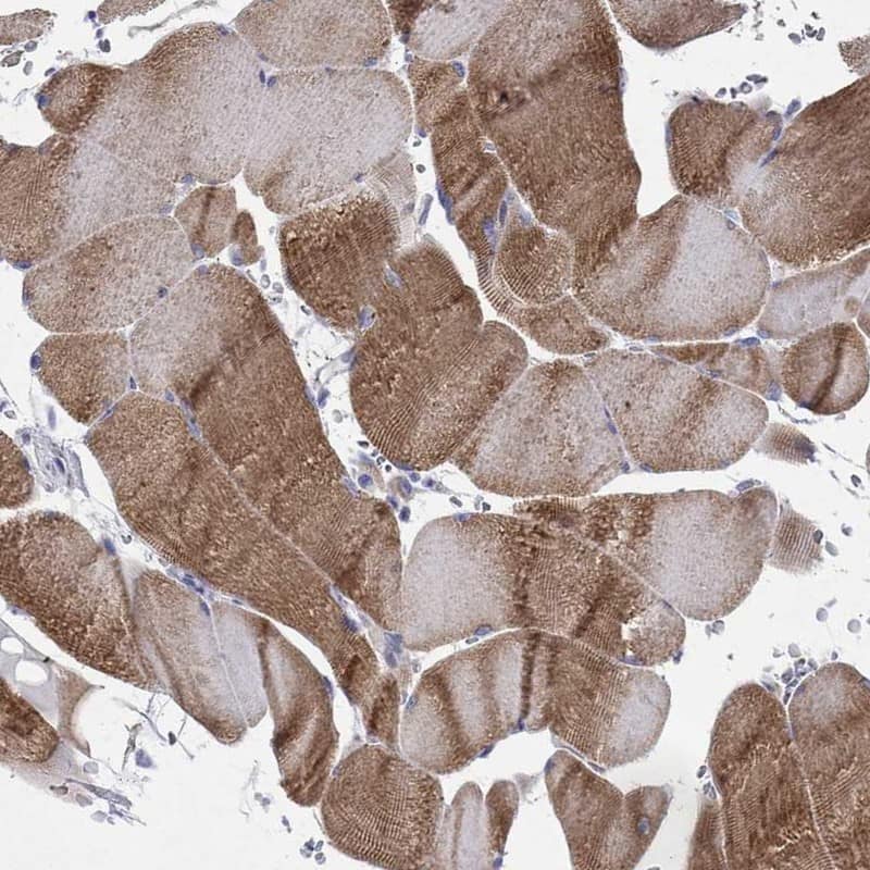 <b>Orthogonal Strategies Validation. </b>Staining of human skeletal muscle shows high expression.