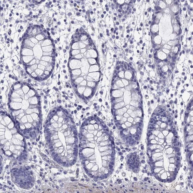 Staining of human rectum shows low expression as expected.