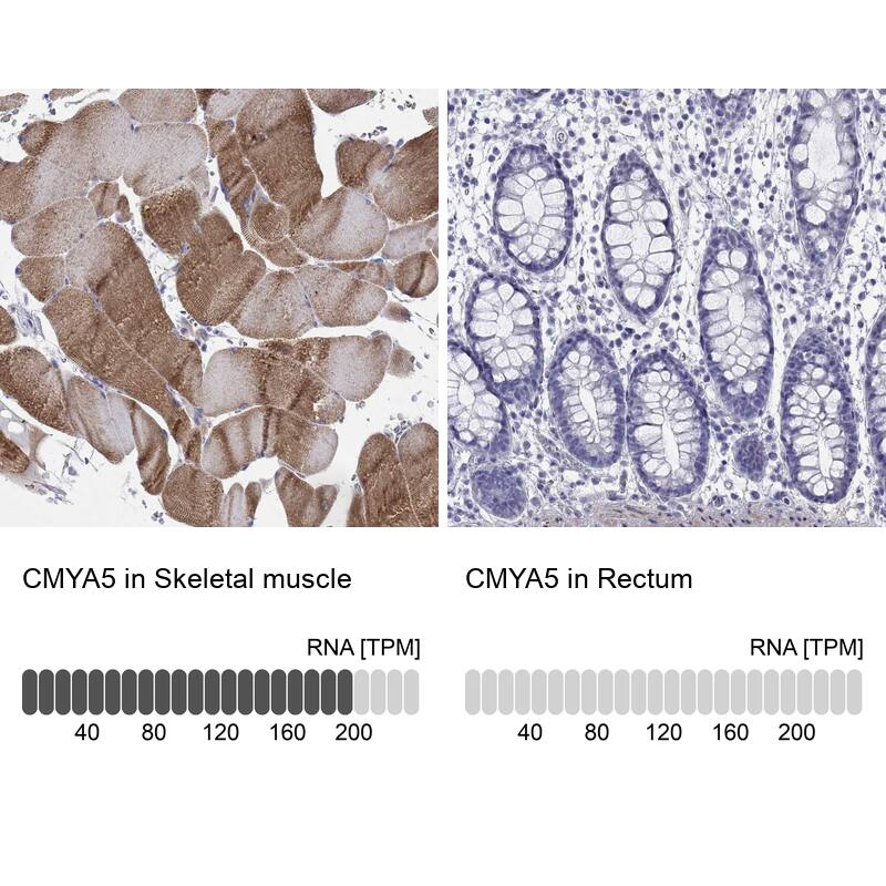 Analysis in human skeletal muscle and rectum tissues using Anti-CMYA5 antibody. Corresponding CMYA5 RNA-seq data are presented for the same tissues.