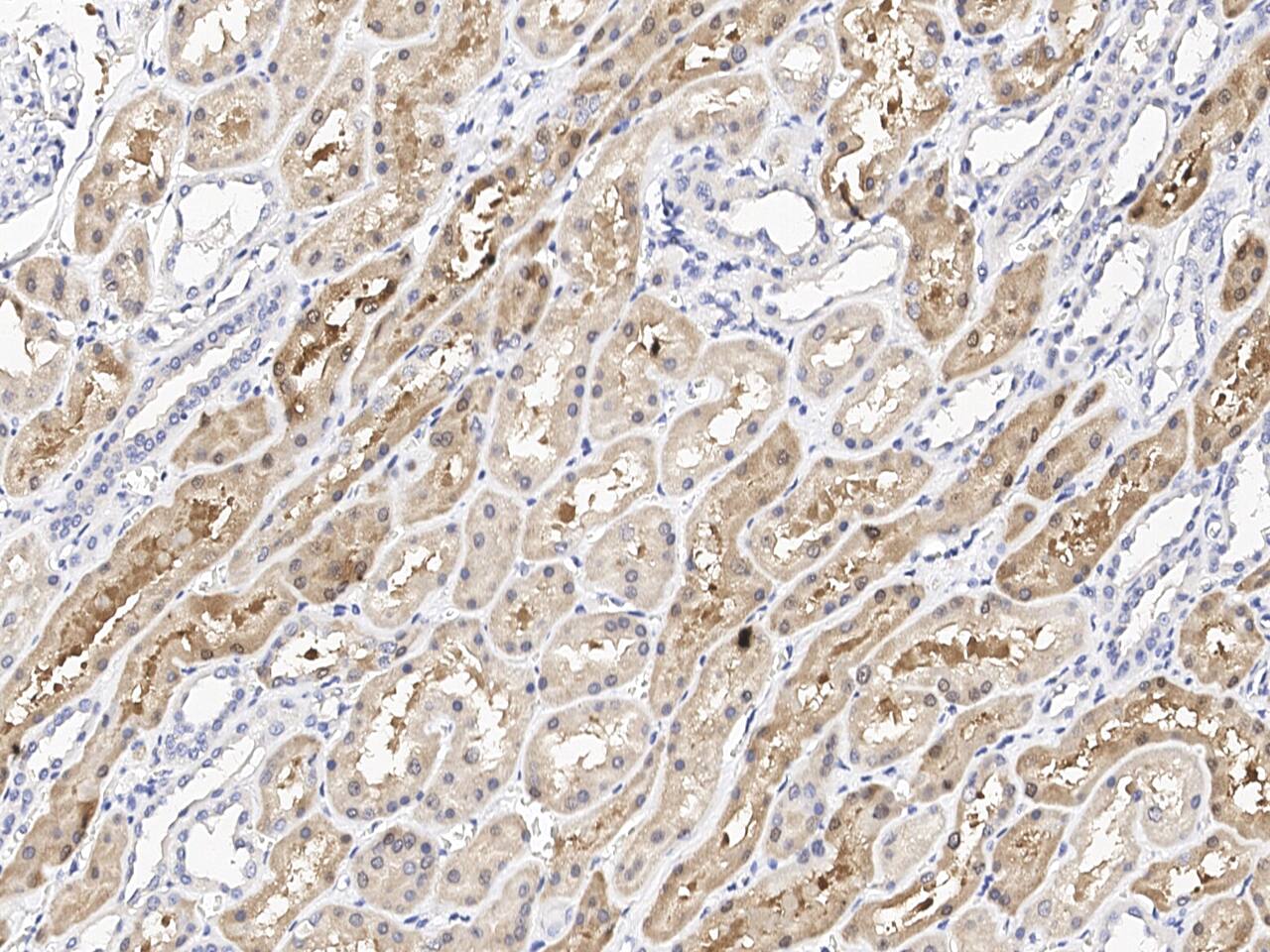 Immunochemical staining of ACY3 in formalin-fixed paraffin embedded section of human kidney with NBP3-21421 at 1:100 dilution, formalin-fixed paraffin embedded sections.