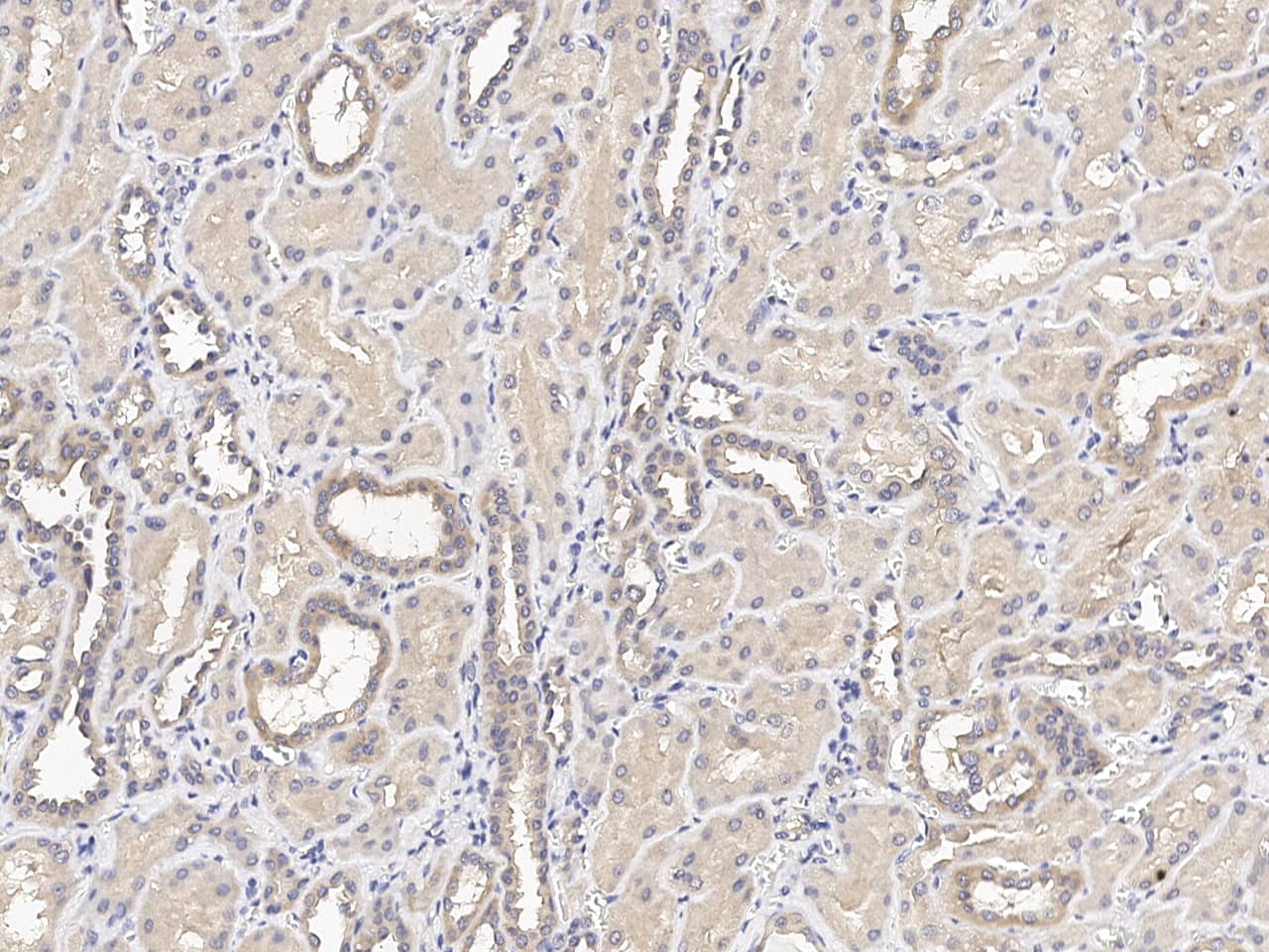 Immunochemical staining of human C12orf4 in formalin-fixed paraffin embedded sections of human kidney with NBP3-21423 at 1:100 dilution