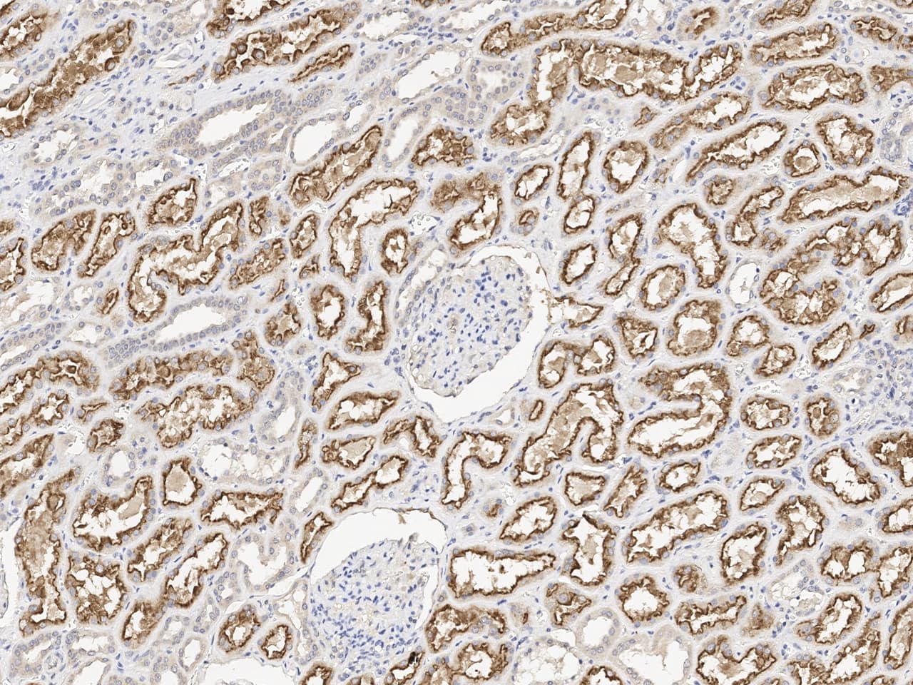 Immunochemical staining of LRP2 in formalin-fixed paraffin embedded sections of human kidney with NBP3-21425 at 1:100 dilution