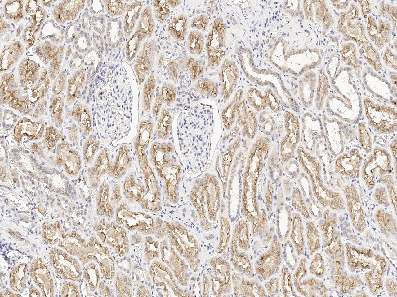 Immunochemical staining of LRP2 in formalin-fixed paraffin embedded sections of human kidney with NBP3-21426 at 1:100 dilution