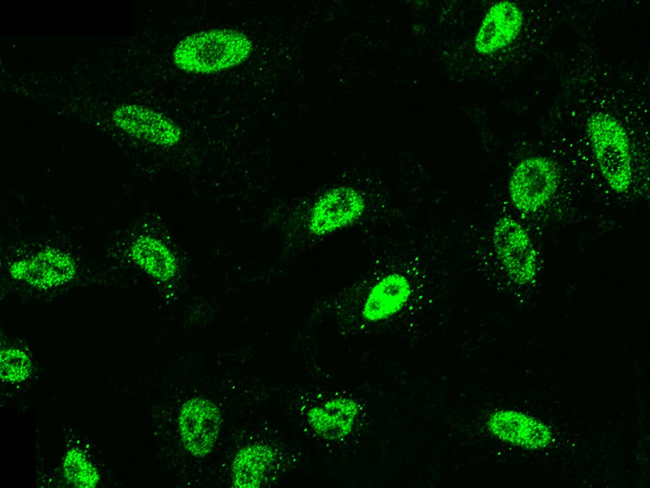 Immunofluorescence staining of RYBP/DEDAF in A549 cells. Cells were fixed with 4% PFA, permeabilzed with 0.3% Triton X-100 in PBS, blocked with 10% serum, and incubated with NBP3-21428 (dilution ratio 1:1000) at 4C overnight. Then cells were stained with the Alexa Fluor 488-conjugated Goat Anti-rabbit IgG secondary antibody (green). Positive staining was localized to nucleus.