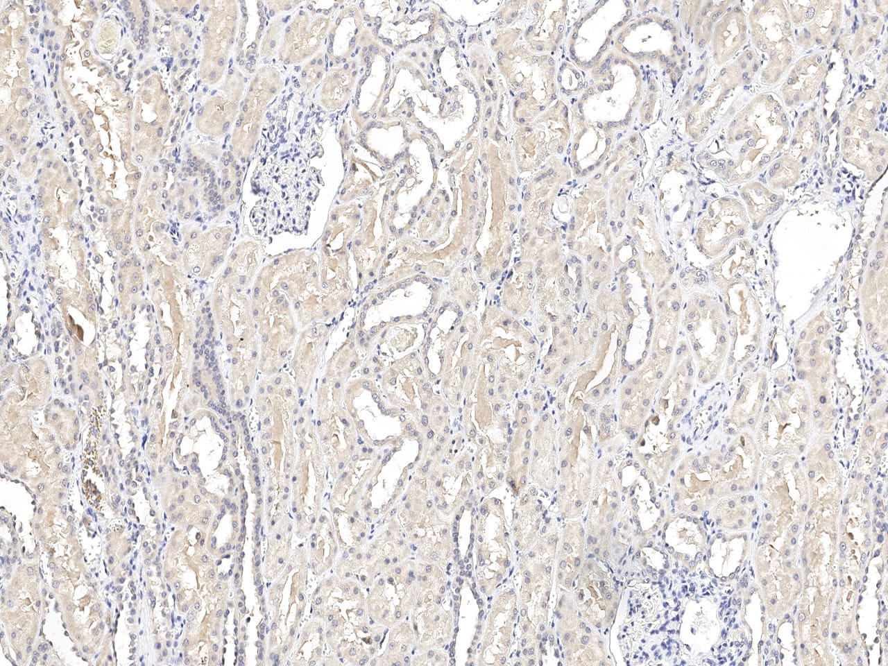 Immunochemical staining of SHMT1 in human kidney formalin-fixed paraffin embedded sections with NBP3-21429 at 1:100 dilution