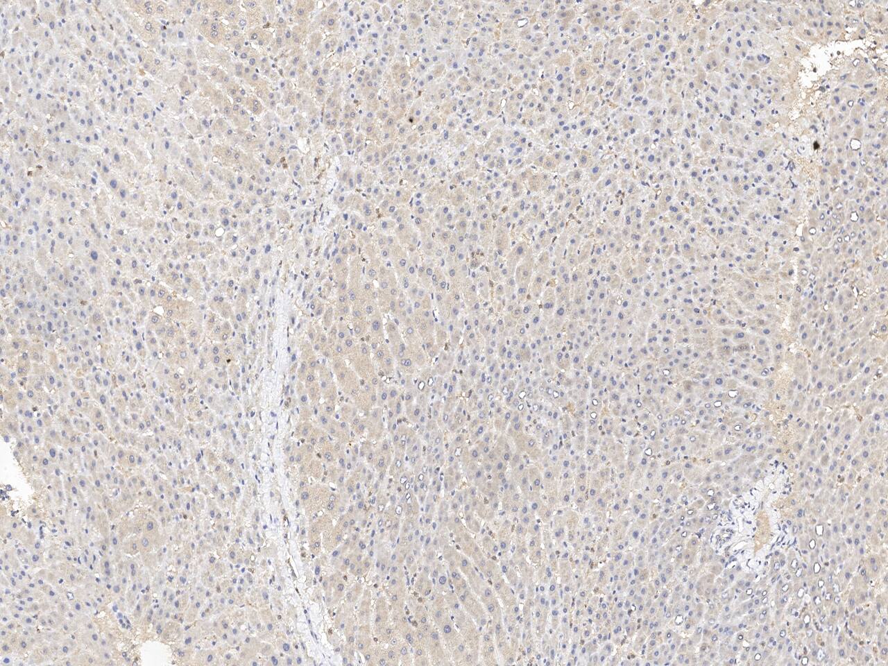 Immunochemical staining of SHMT1 in human liver formalin-fixed paraffin embedded sections with NBP3-21429 at 1:100 dilution