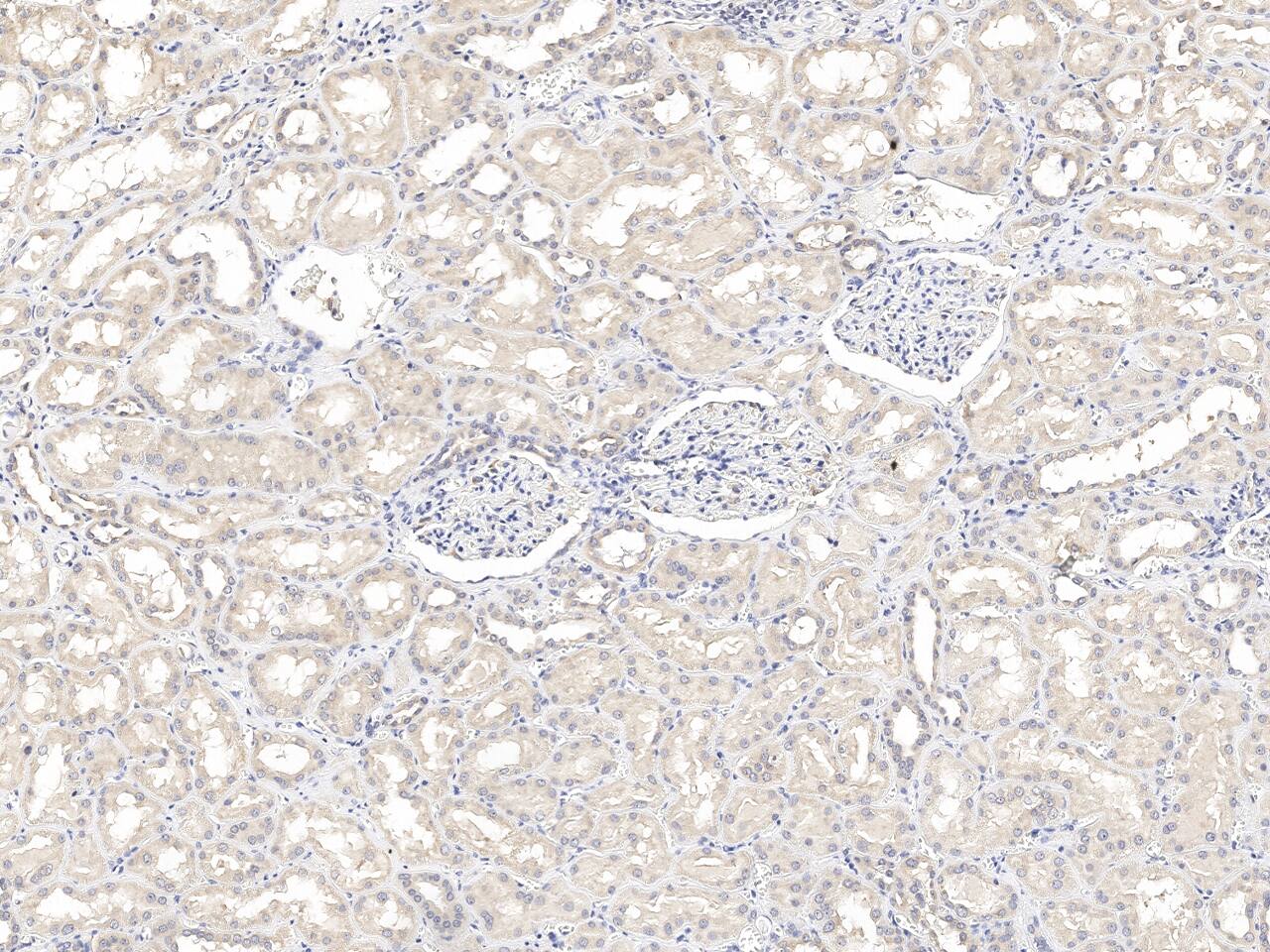 Immunochemical staining of CRTAP in human kidney formalin-fixed paraffin embedded sections with NBP3-21432 at 1:100 dilution