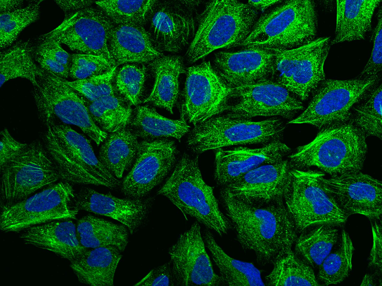 Immunofluorescence staining of CRTAP in U2OS cells. Cells were fixed with 4% PFA, permeabilzed with 0.3% Triton X-100 in PBS,blocked with 10% serum, and incubated with NBP3-21432 (dilution ratio 1:100) at 4C overnight. Then cells were stained with the Alexa Fluor 488-conjugated Goat Anti-rabbit IgG secondary antibody (green) and counterstained with DAPI (blue). Positive staining was localized to Cytoplasm.