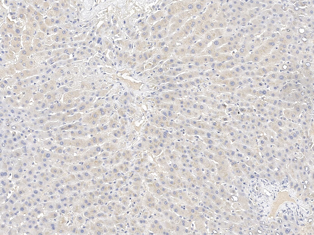 Immunochemical staining of CRTAP in human liver formalin-fixed paraffin embedded sections with NBP3-21432 at 1:100 dilution