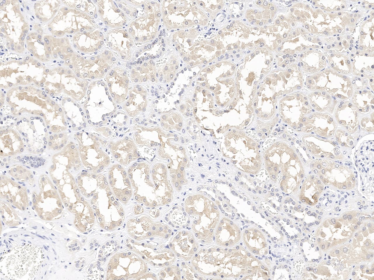 Immunochemical staining of DUSP23 in human kidney formalin-fixed paraffin embedded sections with NBP3-21438 at 1:100 dilution