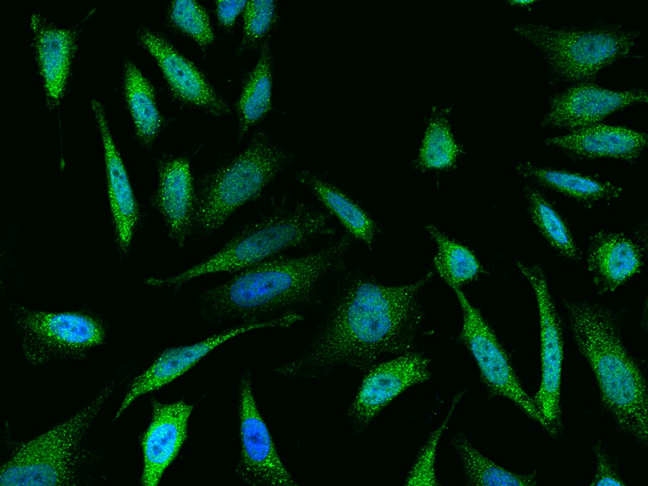 Immunofluorescence staining of DUSP23 in Hela cells. Cells were fixed with 4% PFA, permeabilzed with 0.3% Triton X-100 in PBS, blocked with 10% serum, and incubated with NBP3-21438 (dilution ratio 1:100) at 4C overnight. Then cells were stained with the Alexa Fluor 488-conjugated Goat Anti-rabbit IgG secondary antibody (green) and counterstained with DAPI (blue). Positive staining was localized to Nucleus and Cytoplasm.