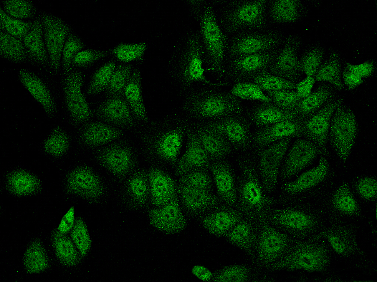 Immunocytochemistry/ Immunofluorescence: Iroquois-class homeodomain protein IRX-5 Antibody [NBP3-21441] - Immunofluorescence staining of Iroquois-class homeodomain protein IRX-5 in HaCaT cells. Cells were fixed with 4% PFA, permeabilzed with 0.1% Triton X-100 in PBS, blocked with 10% serum, and incubated with NBP3-21441 (dilution ratio 1:200) at 4C overnight. Then cells were stained with the Alexa Fluor 488-conjugated Goat Anti-rabbit IgG secondary antibody (green). Positive staining was localized to Nucleus and Cytoplasm.