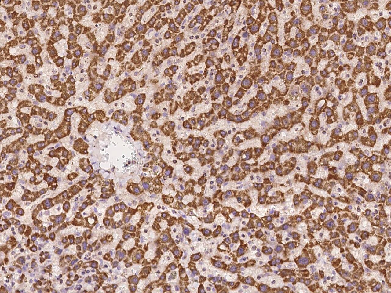 Immunochemical staining of TIMM10 in human liver formalin-fixed paraffin embedded sections with NBP3-21445 at 1:300 dilution